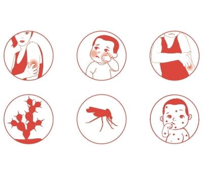 SVR Cicavit+ Spray Sos Prurido 40ml - Image 2