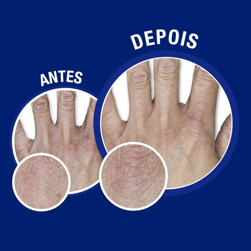 Neutrogena Mãos e Unhas Creme 75ml - Image 2