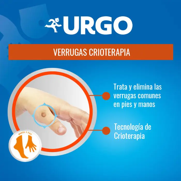 Urgo Verrugas Aplicador Crioterapia Tecnologia - 38ml 2 Urgo Verrugas Aplicador Crioterapia Tecnologia - 38ml - Image 2